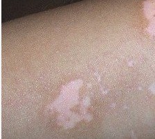 �人��ͯ����Ԥ������