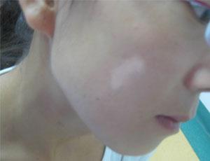 �人��������Ԥ������ô����